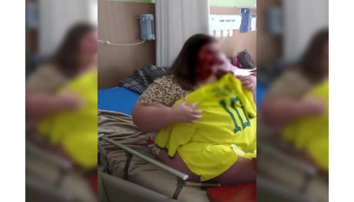Entenda mutação genética diagnosticada em menina de 11 anos com mais de 200 kg